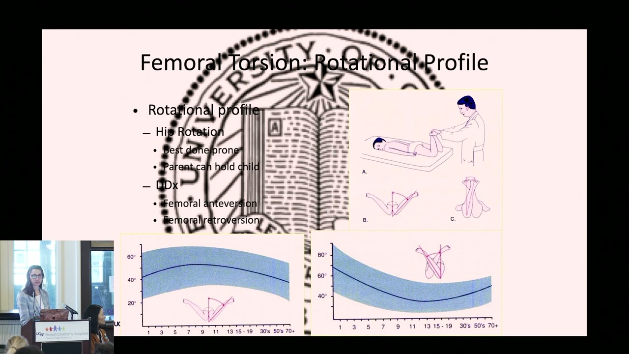 Lower Limb Differences: Angular (In toeing, Out toeing), Rotational (Bow legs, Knock knees)   Cases