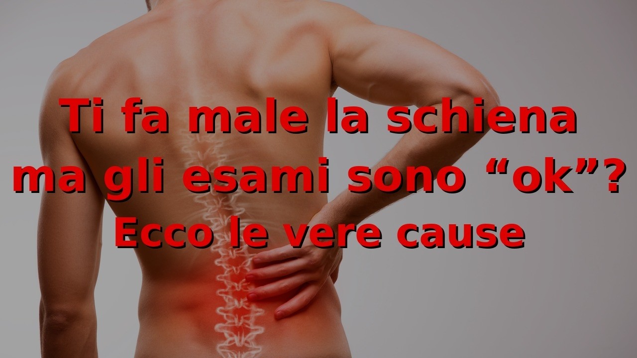 Ti fa male la schiena ma gli esami sono “ok”? Ecco le vere cause (Faccette, Ernia, Nervi)