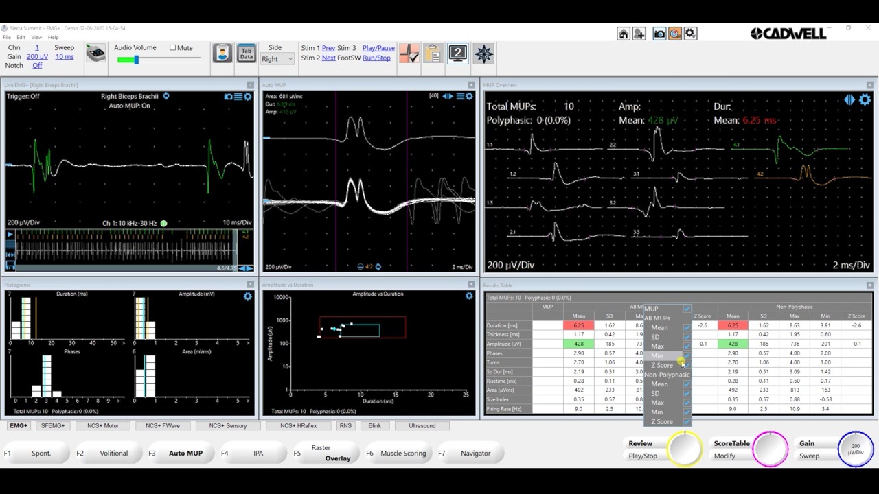 EMG+ Advanced Functions 2   Auto MUP