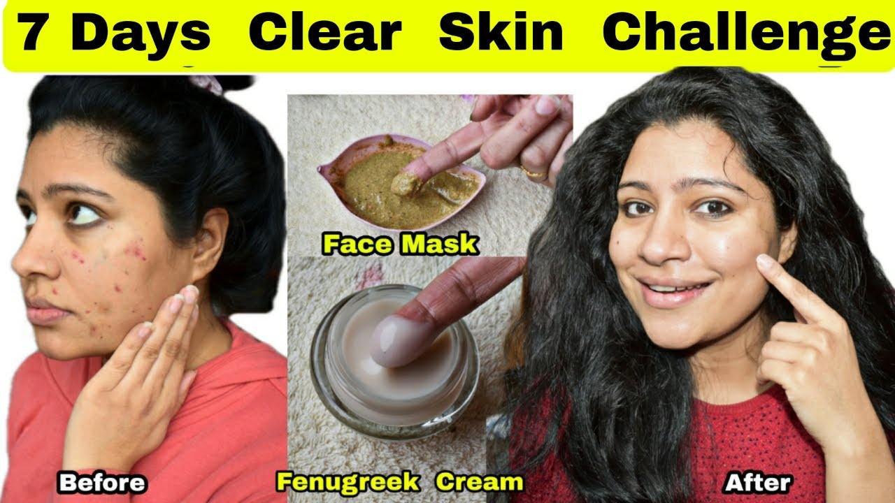 7 Days Clear & Glowing Skin Challenge : Remove Pimples, Acne, Scars, Pigmentation, Blackheads