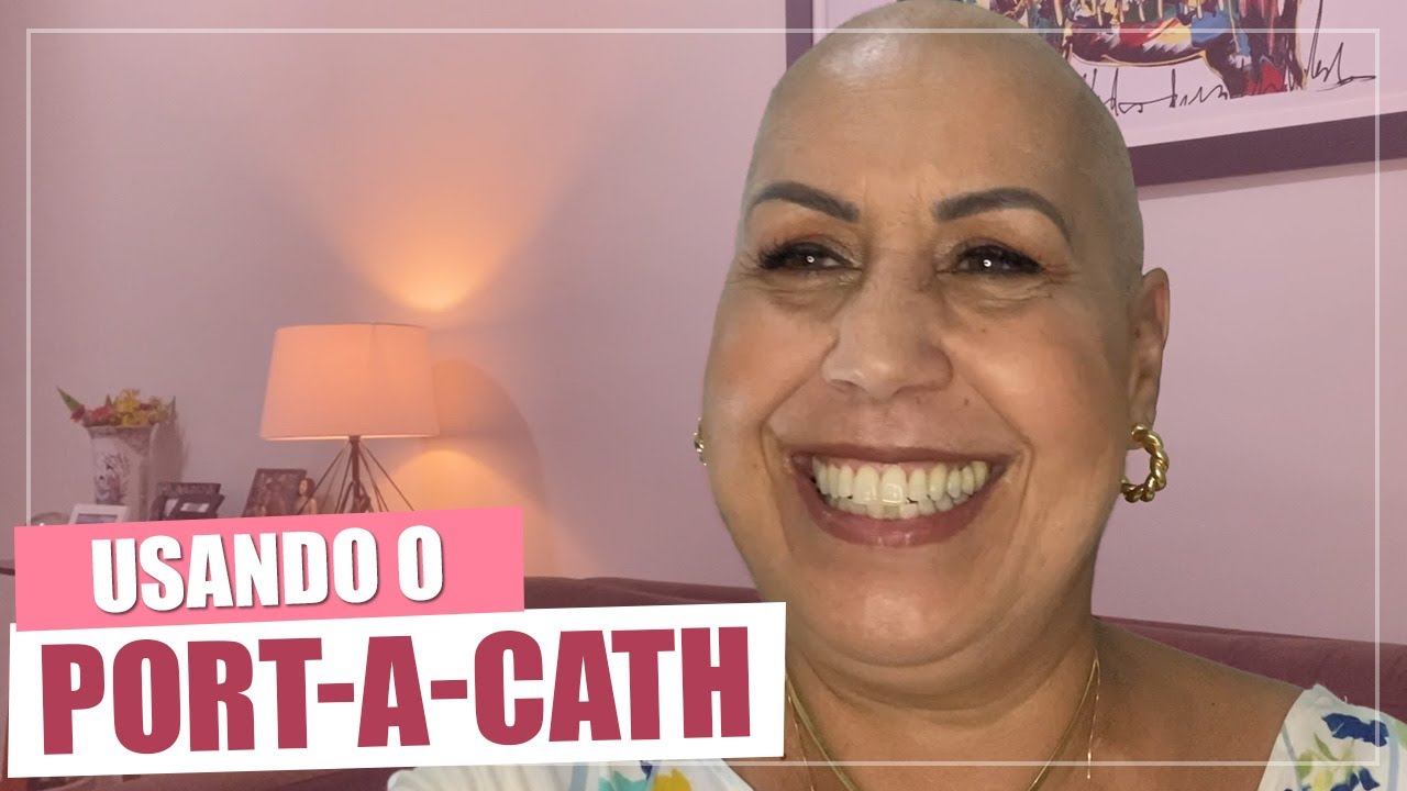 Usando o Porth a cath | Supervivente 433