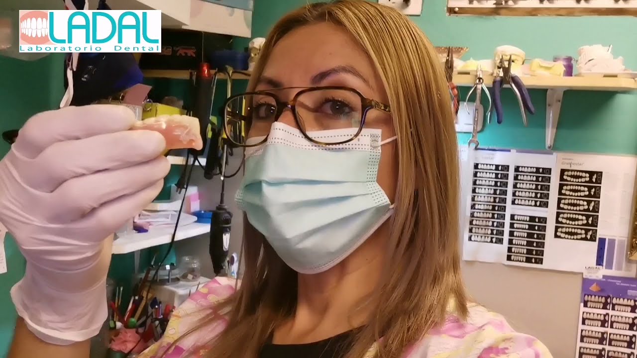 Reparación de prótesis dental total inferior partida a la mitad