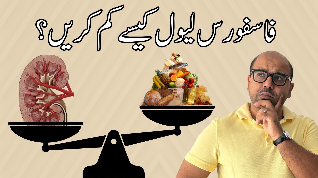 Best Phosphorus Diet Plan | AwaisZaka.com | Episode 172