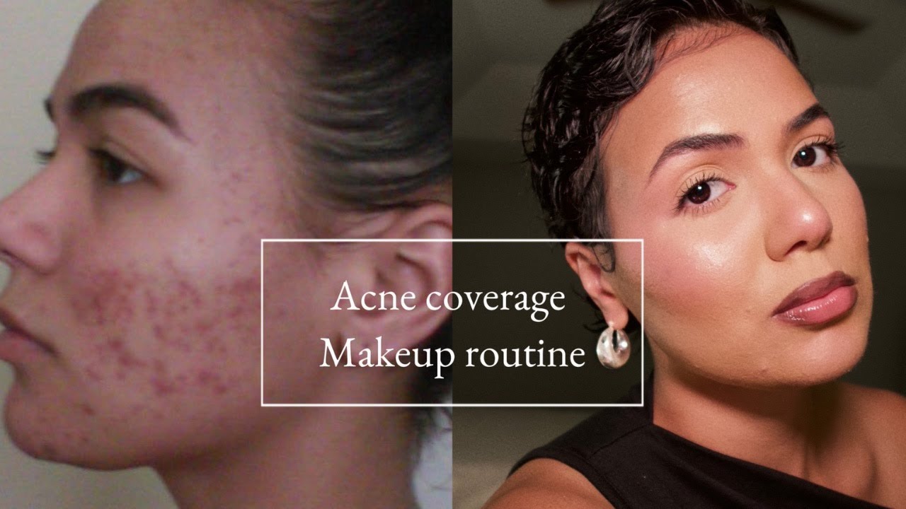 Flawless Acne Coverage Routine | Full Coverage Foundation for Textured Skin