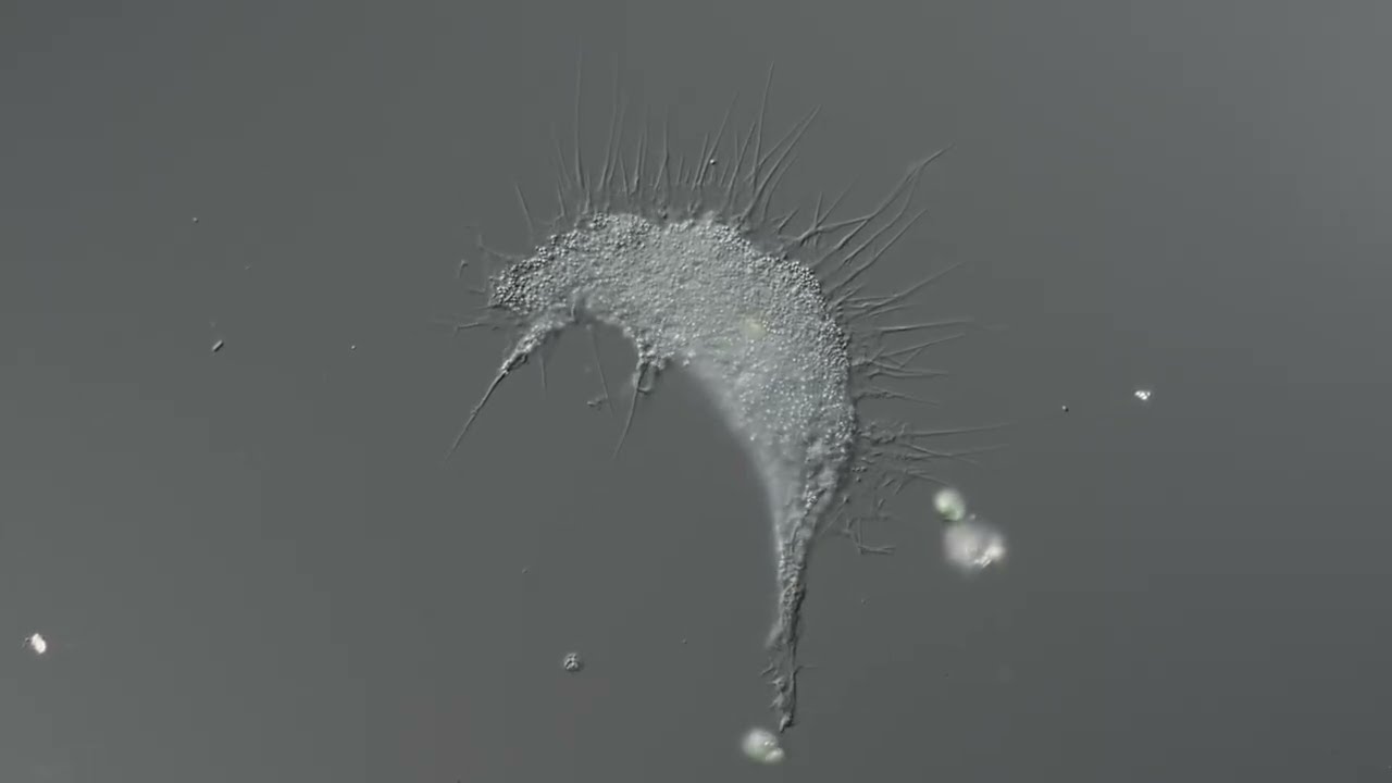 Leptophrys sp. - several specimens