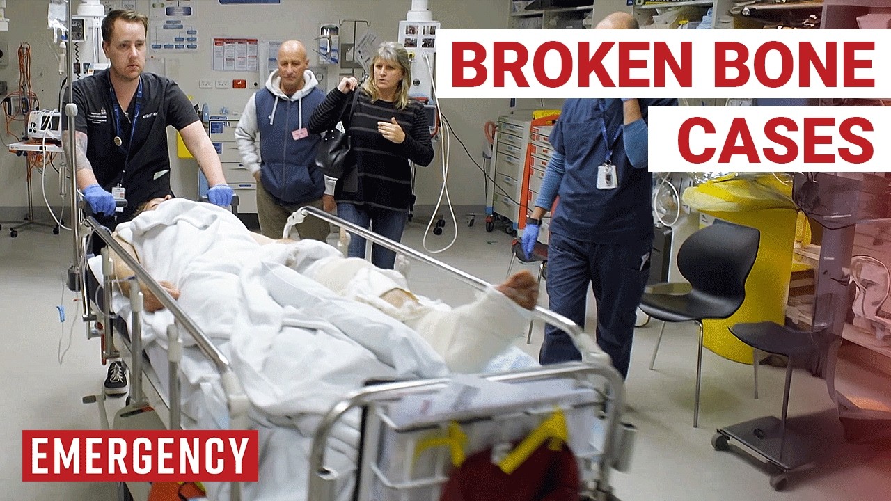 The Worst Fractures Ever Seen In ER!
