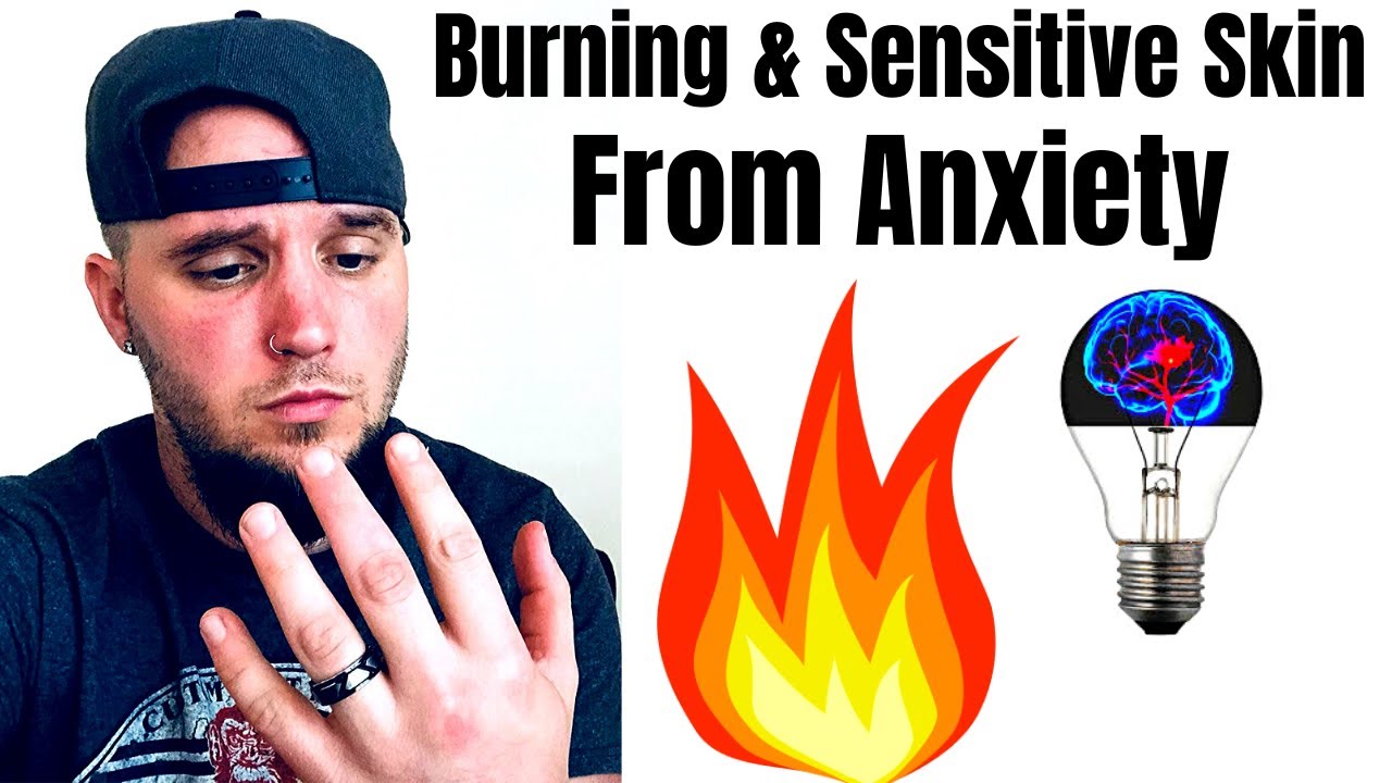 BURNING SENSATIONS & SENSITIVE SKIN FROM ANXIETY (PAINFUL SYMPTOM!)