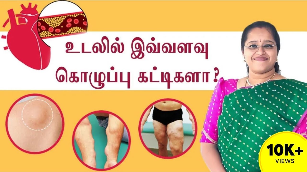 உடலில் இவ்வளவு கொழுப்பு கட்டிகளா ? | Lipoma & Multiple Lipomatosis | Dr A.Veni | Trichy