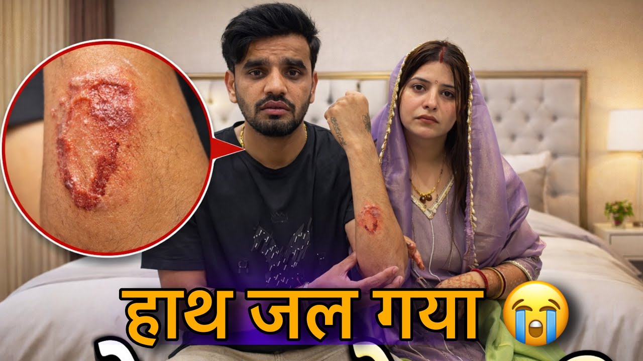आज जल गया मेरा हाथ 🥺 || daily vlog || Prince Verma￼