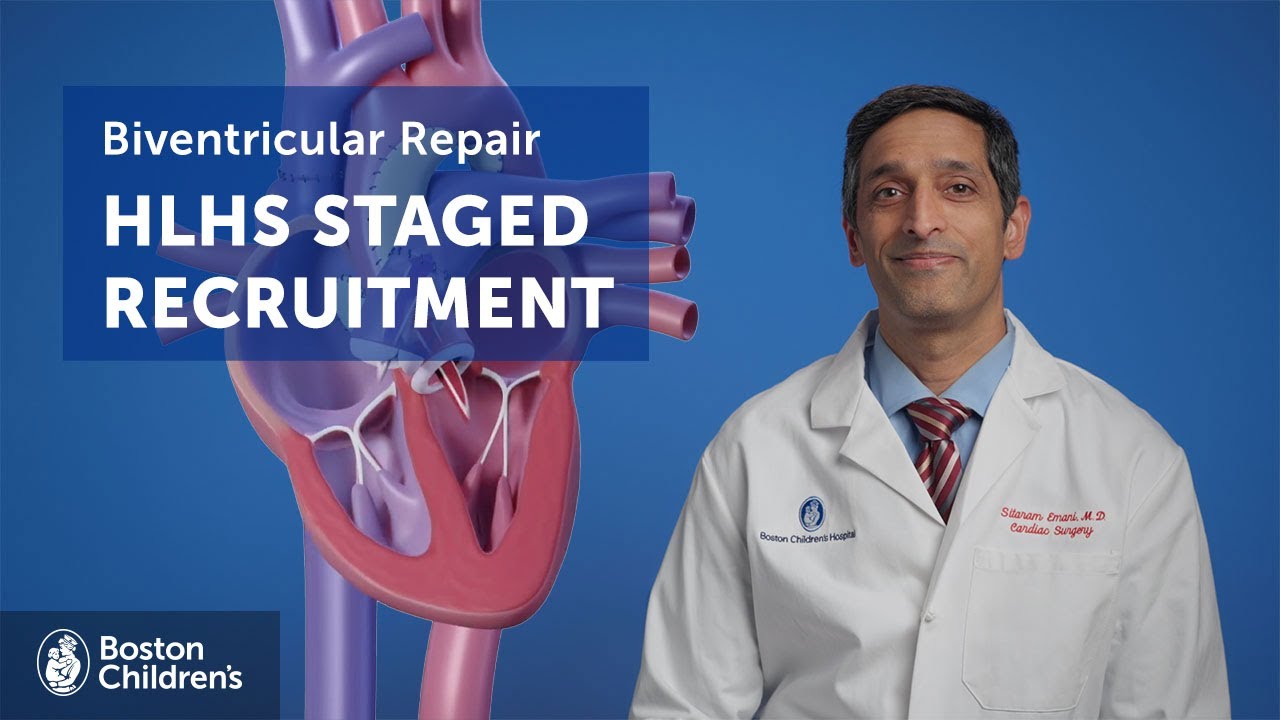 What is Hypoplastic Left Heart Syndrome (HLHS) Staged Recruitment? | Boston Children's Hospital