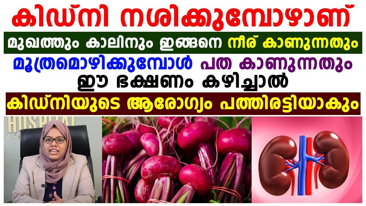 ഈ ഭക്ഷണം കഴിച്ചാൽ കിഡ്നിയുടെ ആരോഗ്യം പത്തിരട്ടിയാകും|