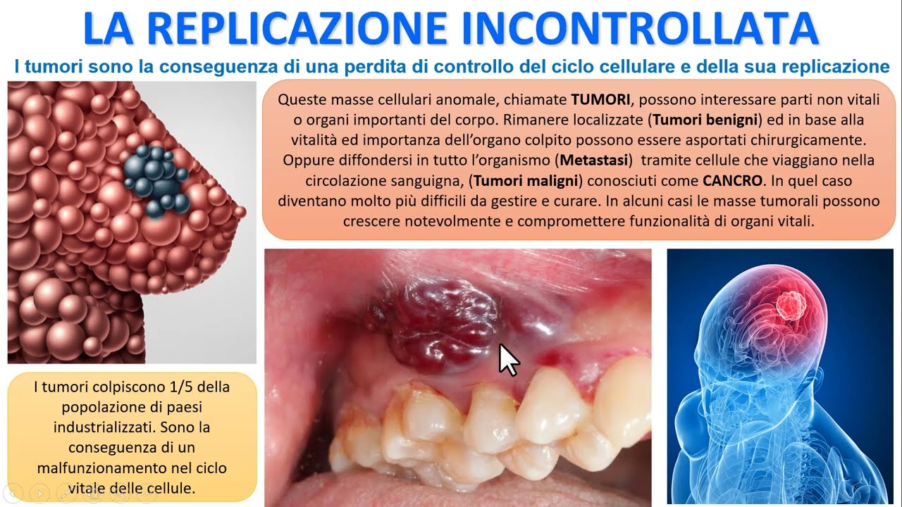 LE CELLULE TUMORALI ED I TUMORI