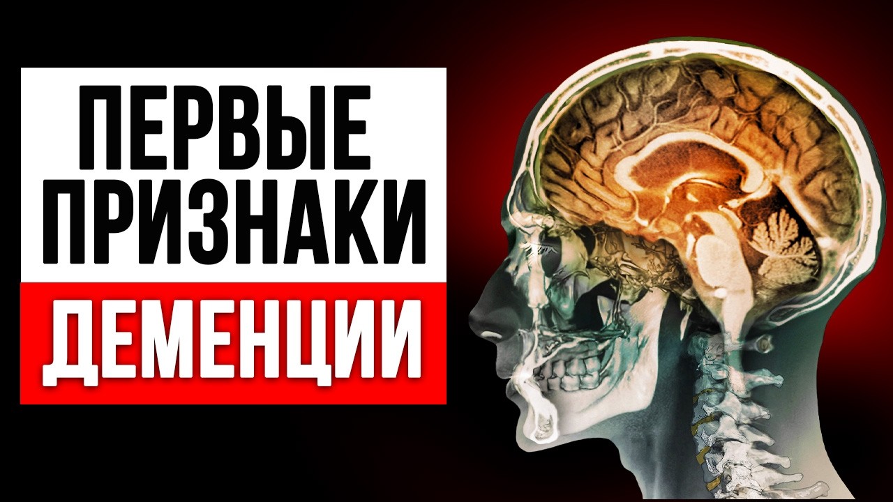 ДЕМЕНЦИЯ НАЧАЛАСЬ, если человек говорит ЭТУ ФРАЗУ! / Как распознать ранние признаки деменции?