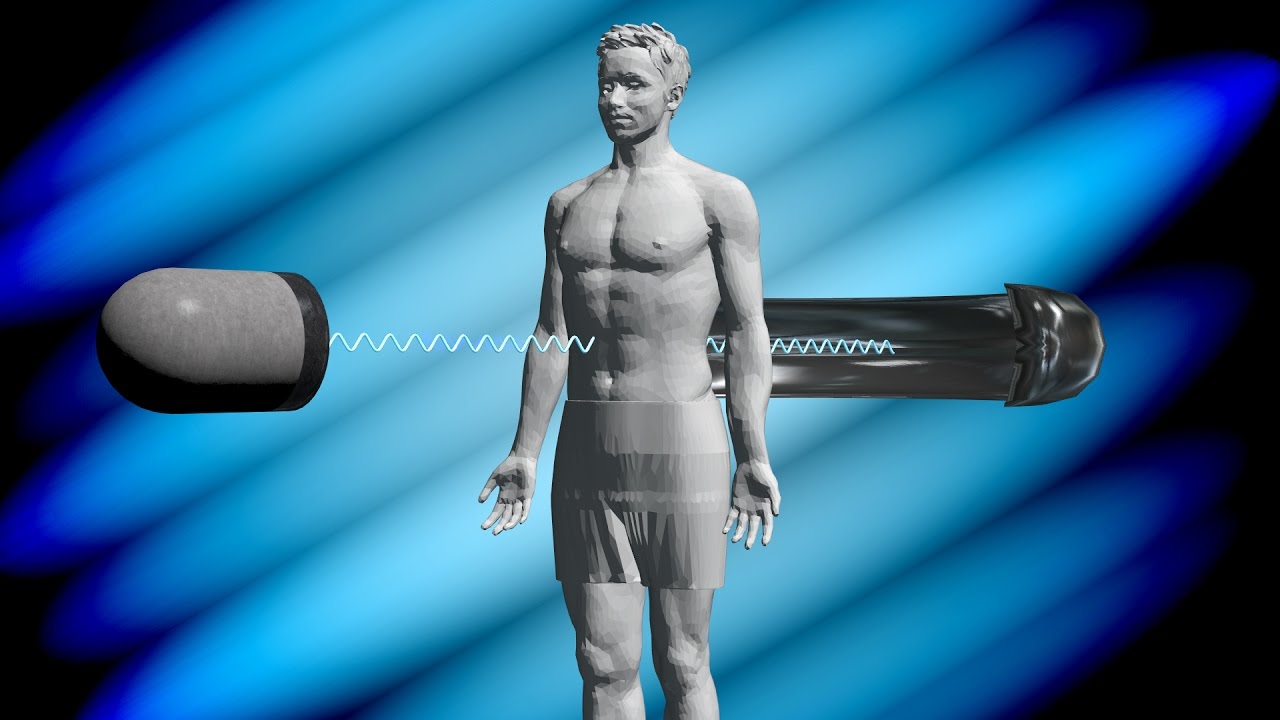 How Does a CT Scan Work?