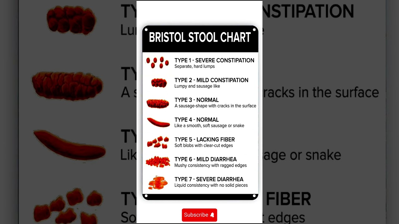 Bristol Stool Chart 🚽 | What Your Poop Says About Your Health