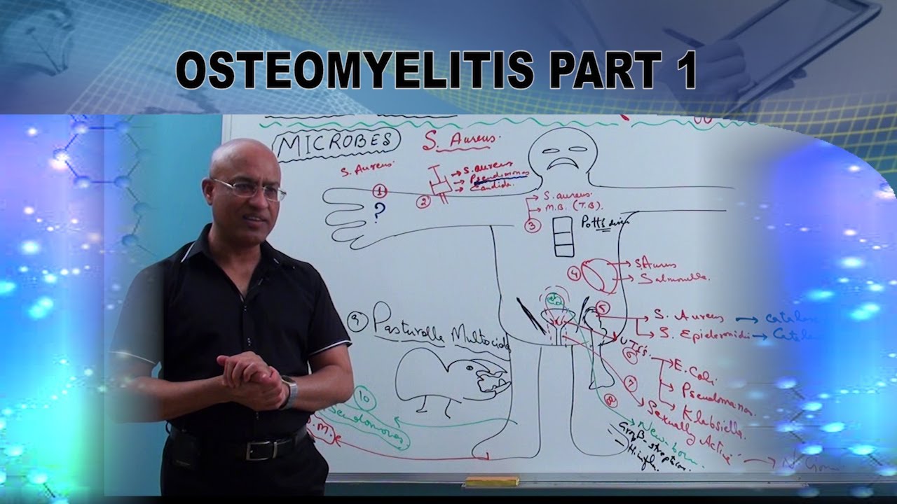 Osteomyelitis | Causes & Symptoms | Bone Infection🩺