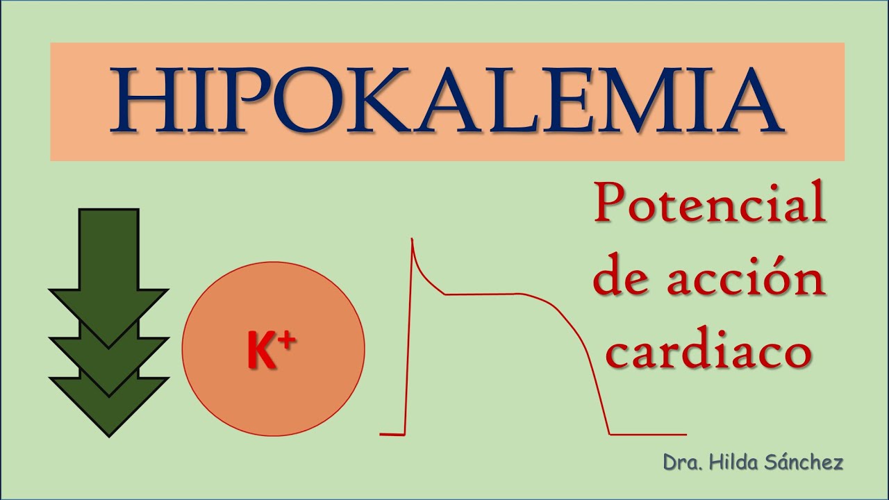 HIPOKALEMIA y corazón ⚡ | Efectos en el potencial de acción cardiaco y urgencias