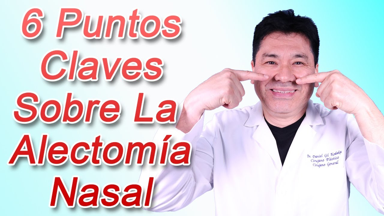 La Alectomía Nasal - 6 Puntos Claves