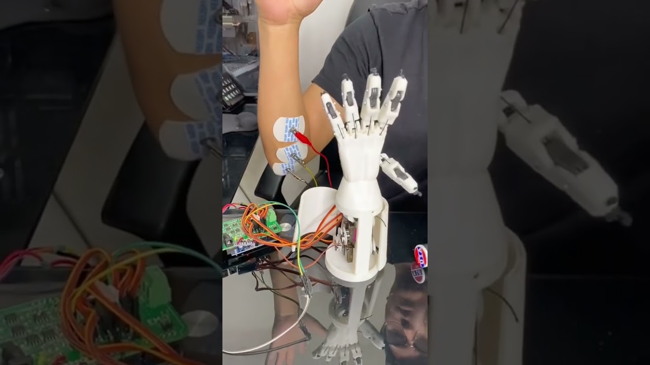 Prototipo Bi&oacute;nico- Control con se&ntilde;al EMG Muscular