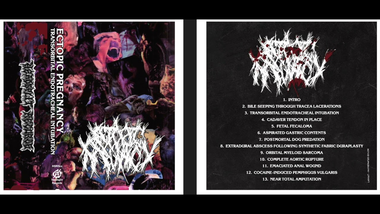 Ectopic Pregnancy - "Transorbital Endotracheal Intubation" (Full EP 2025) [Gore Grind]