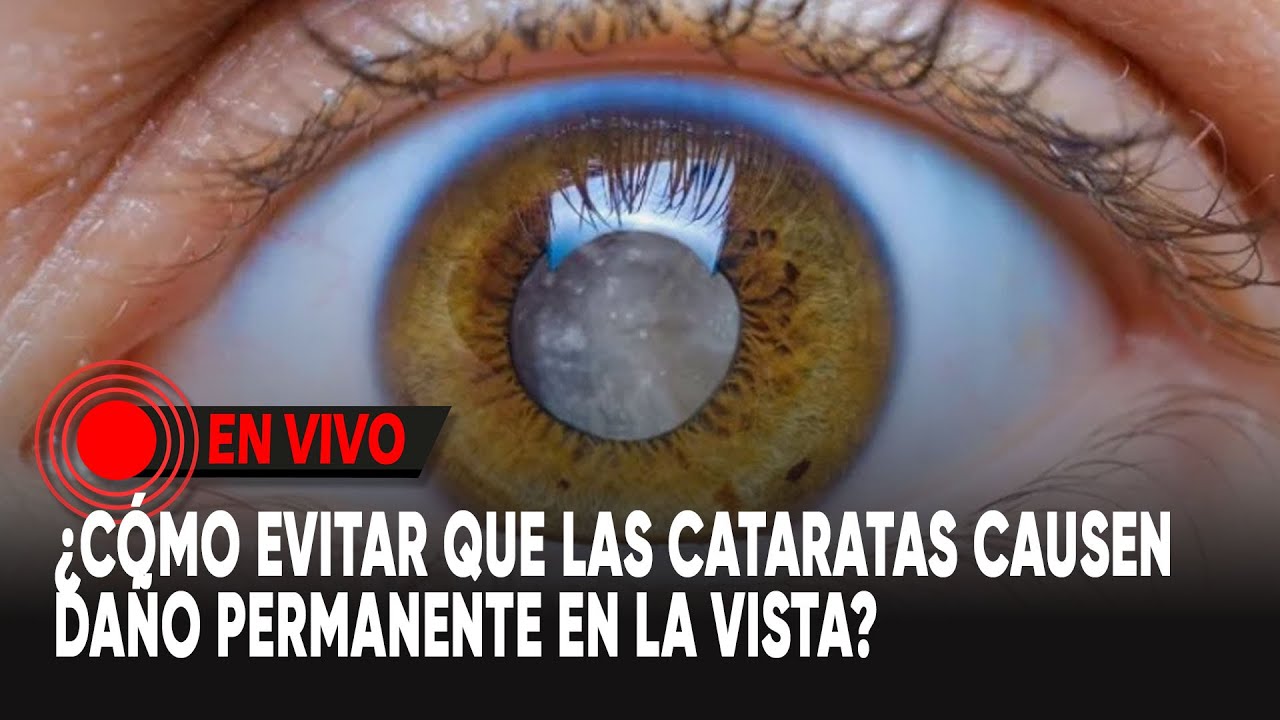 ¿Cómo evitar que las cataratas causen daño permanente en la vista?