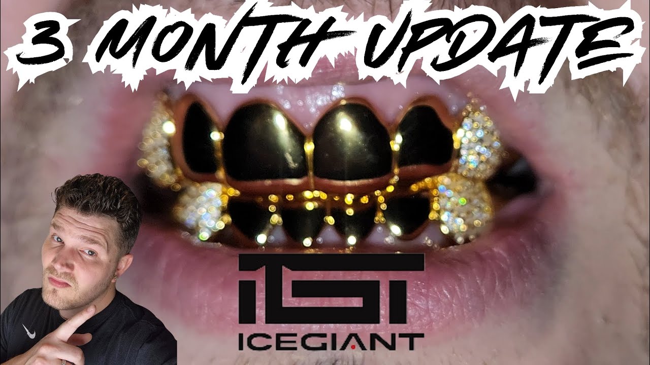 ОБНОВЛЕНИЕ ICEGIANT GRILLZ! Насколько хорошо позолоченные гриллзы держатся долго?