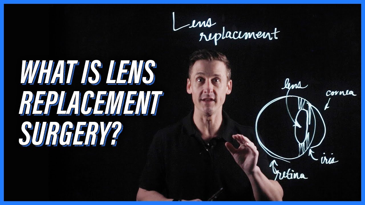Introduction to Lens Replacement surgery