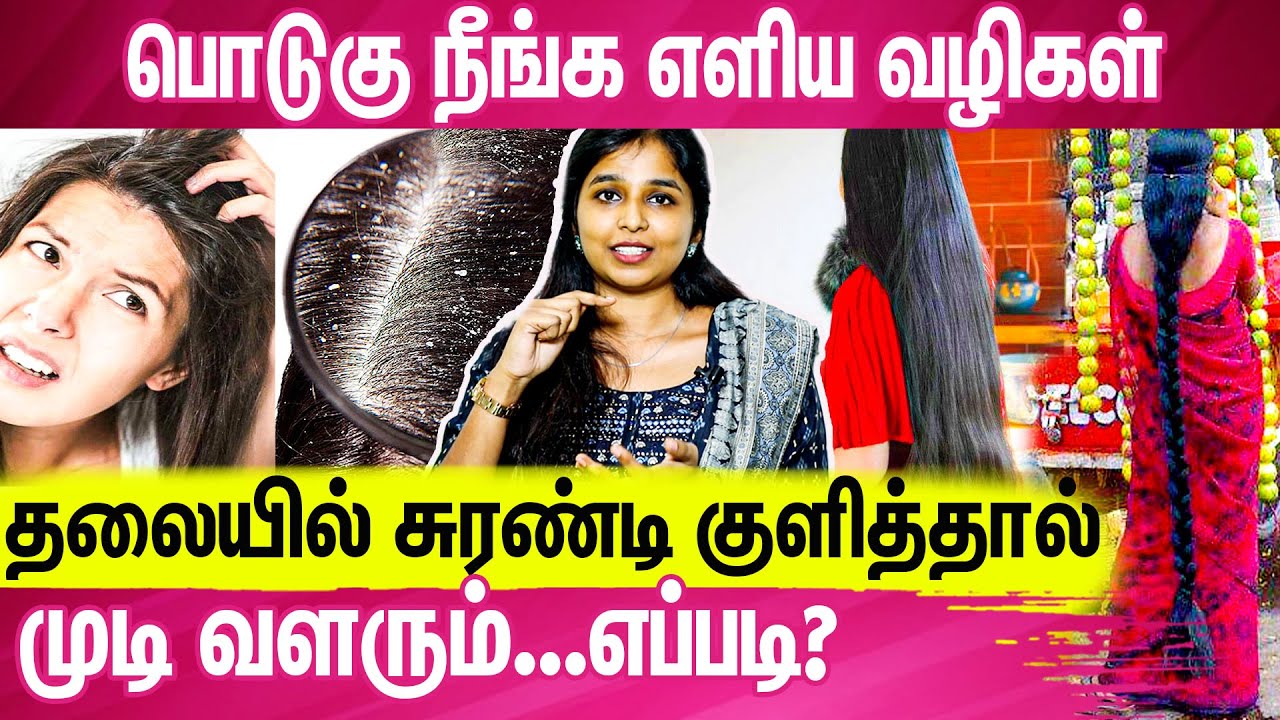 தலைமுடி நீளமாக வளர என்ன செய்ய வேண்டும் | Siddha Doctor Sharmika Interview About Hair Growth