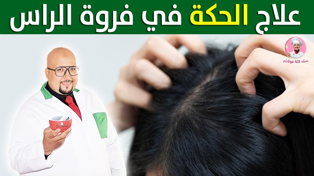 وصفة لعلاج الحكة في فروة الراس من عند الدكتور عماد ميزاب @sanalalamoulati