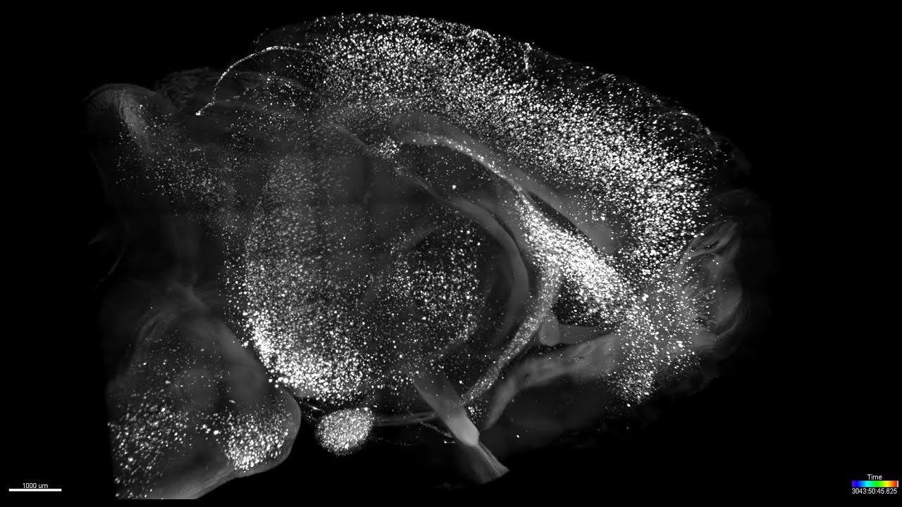 Whole-brain imaging of &beta;-Amyloid staining with tissue clearing techniques