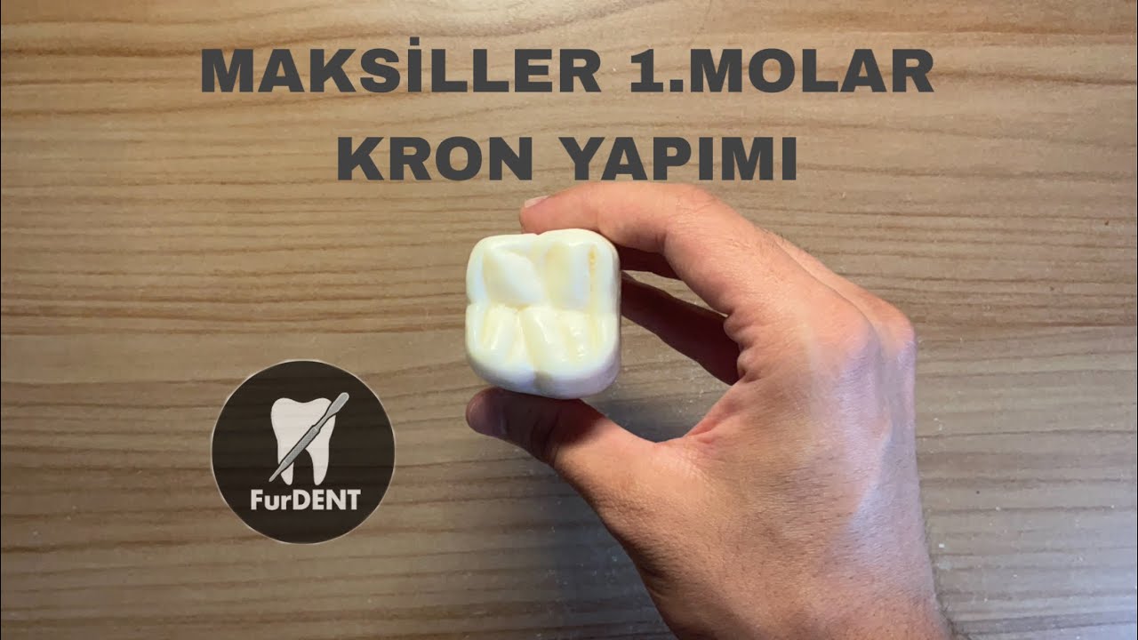 Sabundan Maksiller 1.Molar Diş Yapımı(KRON BÖLÜMÜ)-Maxillary First Molar-🦷