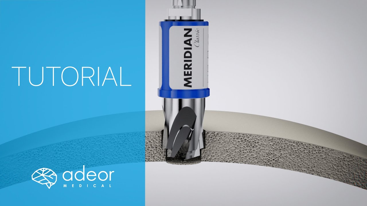 Tutorial - Meridian Classic Single-Use Cranial Perforator