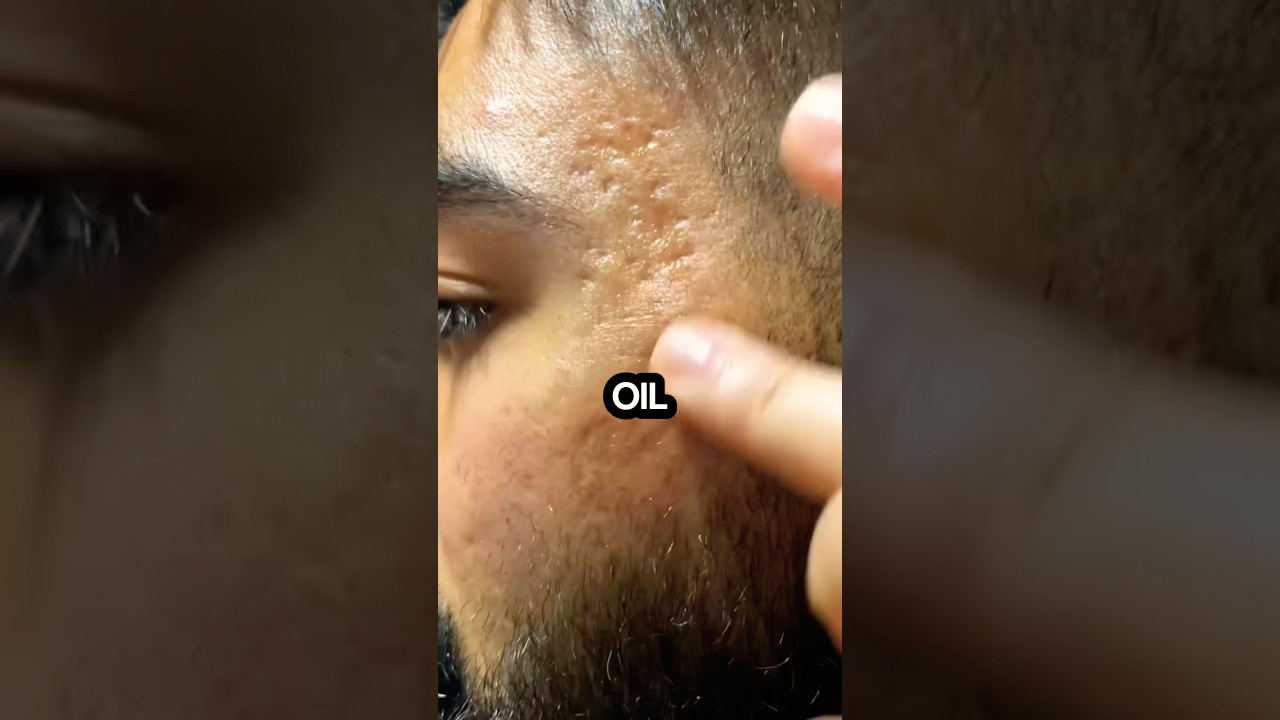 These Oils Help With Everything From Dry Skin to Anti Aging