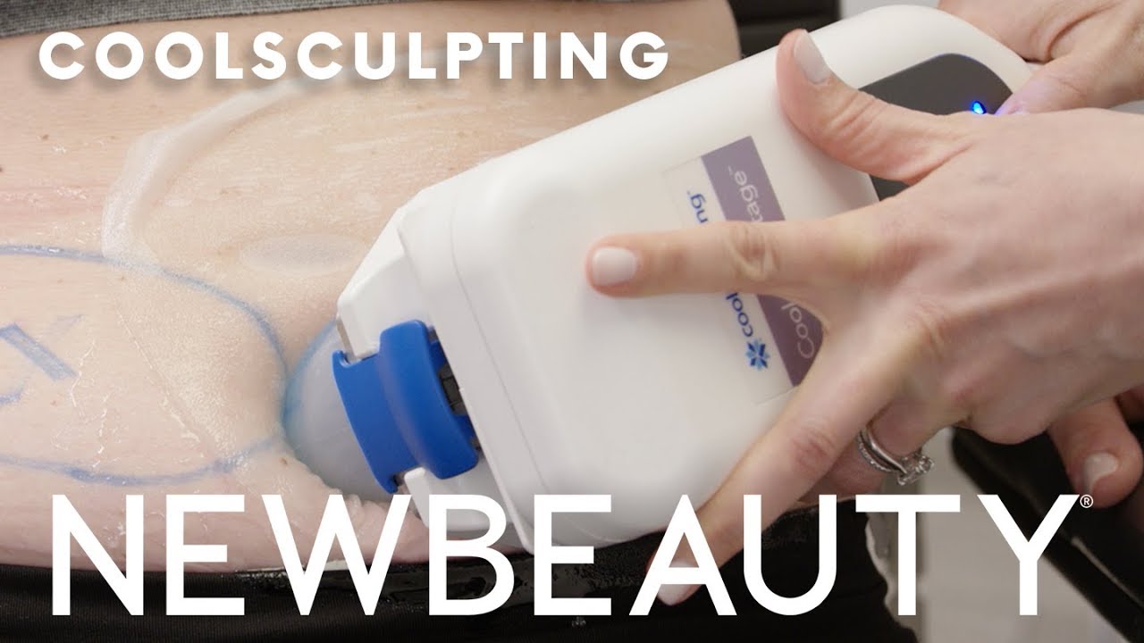 Does CoolSculpting Work? Exactly What to Expect From the Fat Freezing Treatment | NewBeauty