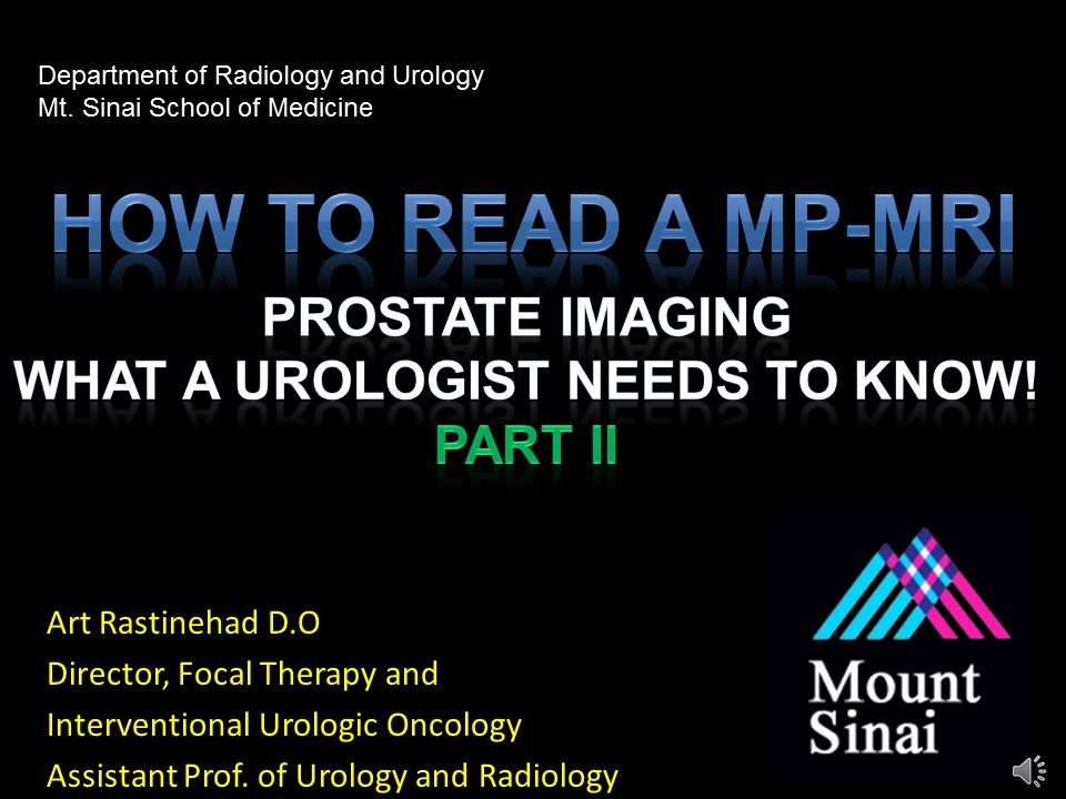 2B   Prostate Imaging What a Urologist Should Know II