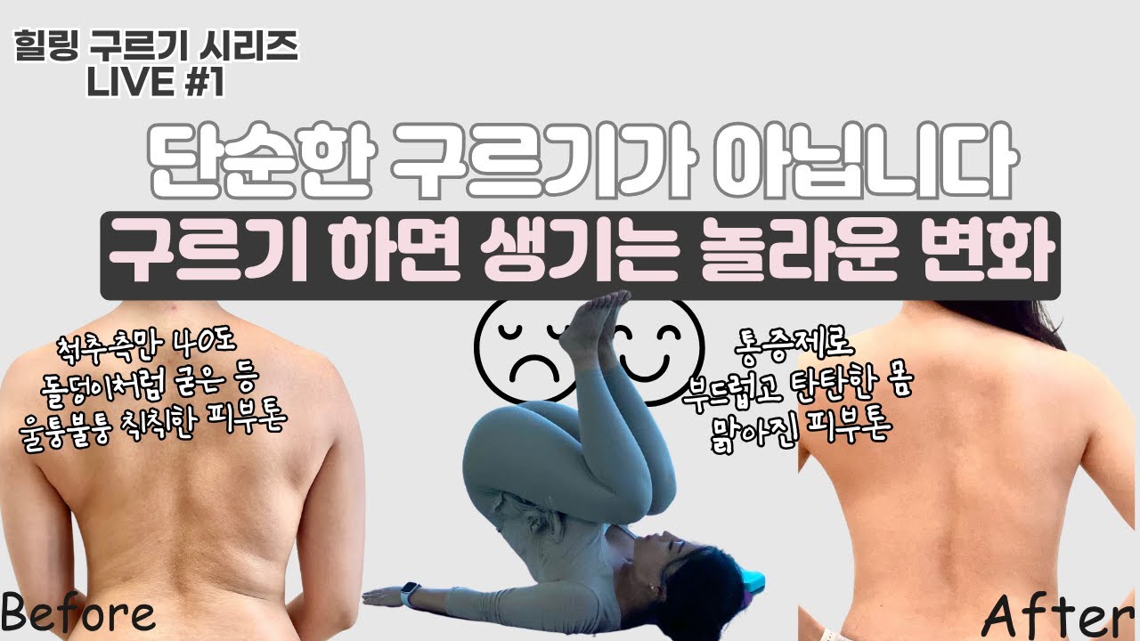 [구르기 변화/이론] SNPE로 척추측만 회복한 리얼 스토리ㅣ구르기 운동하면 생기는 변화 l SNPE 힐링 구르기LIVE 강의 [1편]