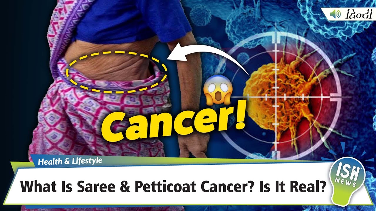 What Is Saree & Petticoat Cancer? Is It Real? | ISH News