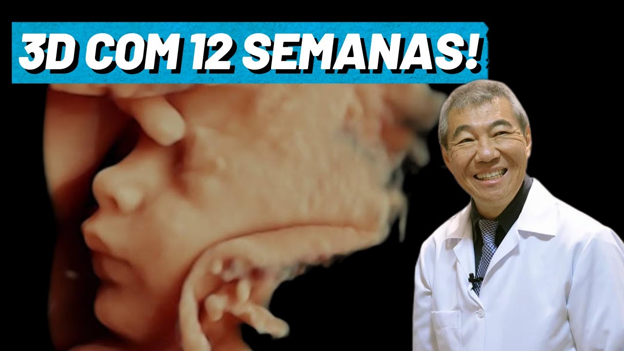 ULTRASSOM 3D COM 12 SEMANAS!