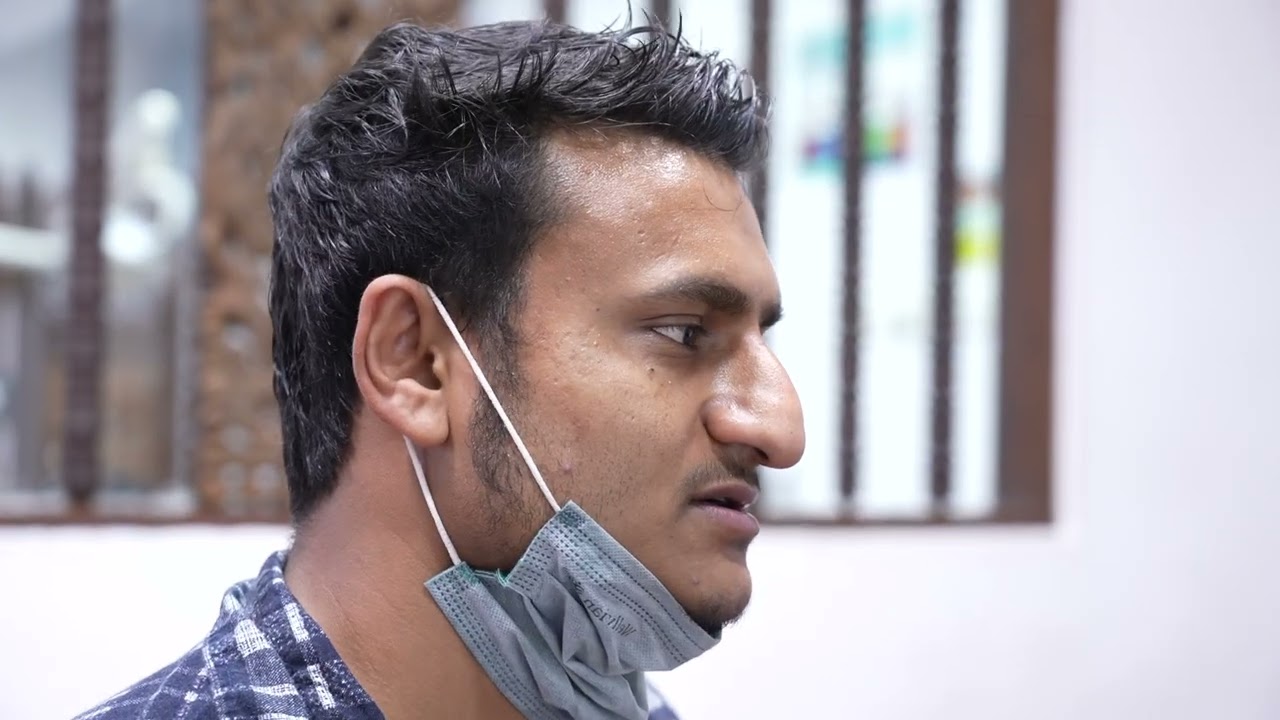 Man with very Large Nose - Rhinoplasty Consultation
