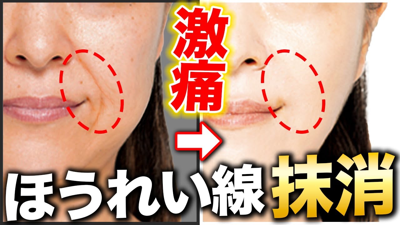 3分でできる！ほうれい線&口元の脂肪を同時に消す方法