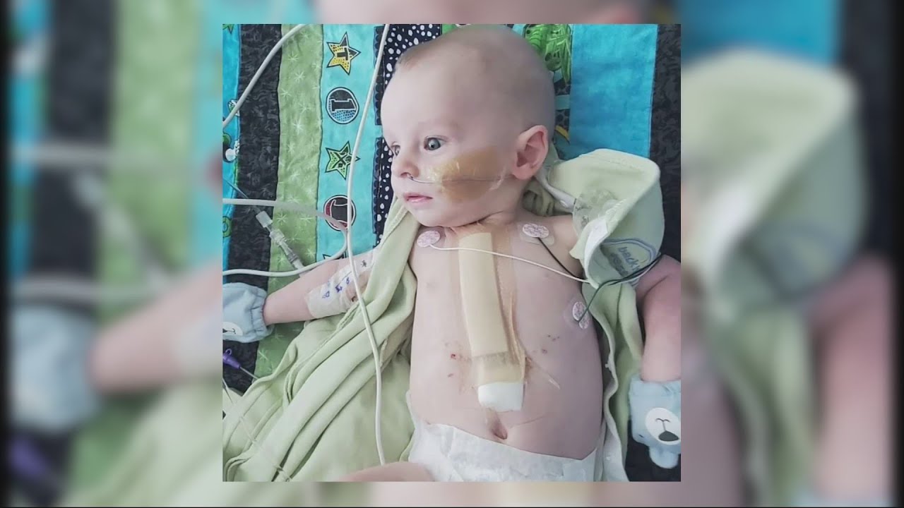 Parents detail newborn's recovery from heart defect surgery