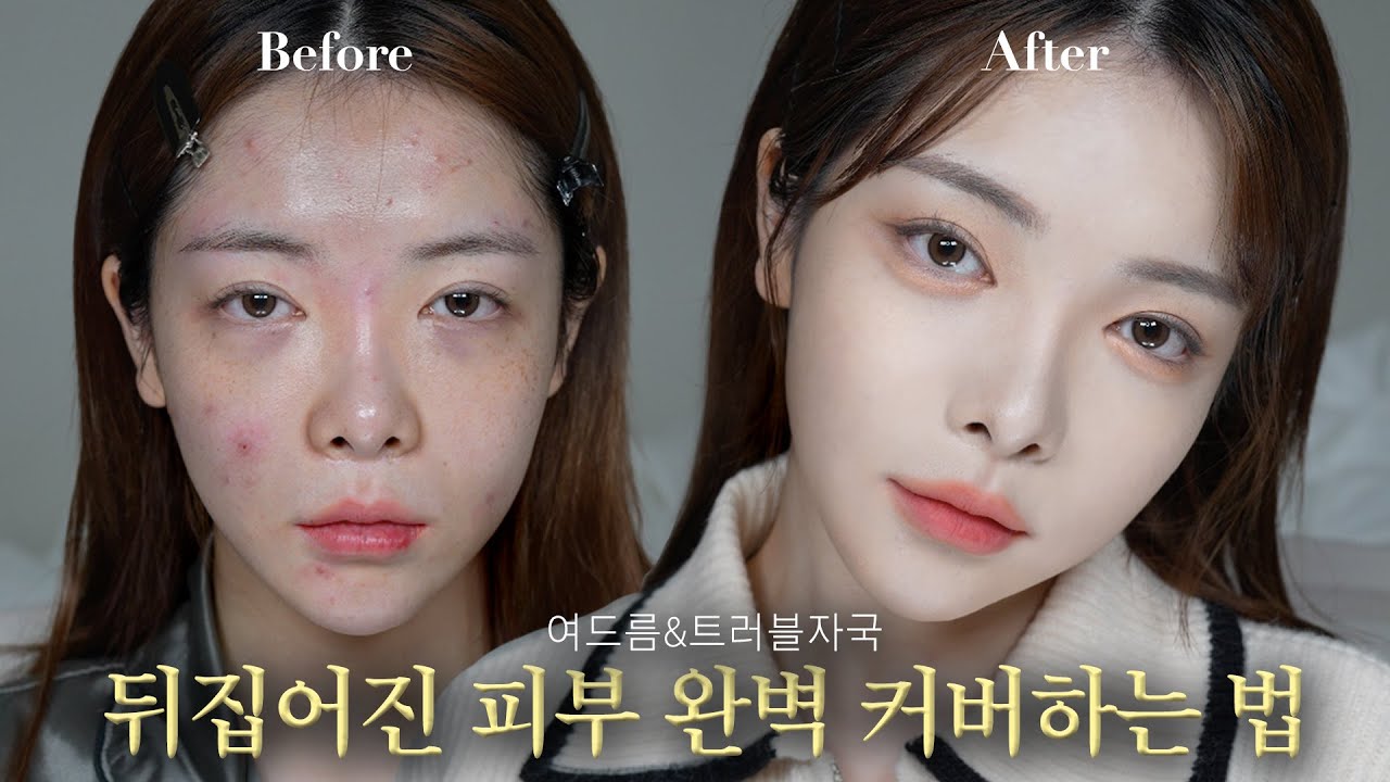 피부 컨디션 최악..😱트러블 피부도 가능한 