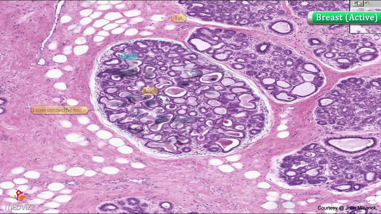Histology of Breast (active / Lactating ) : Shotgun Histology