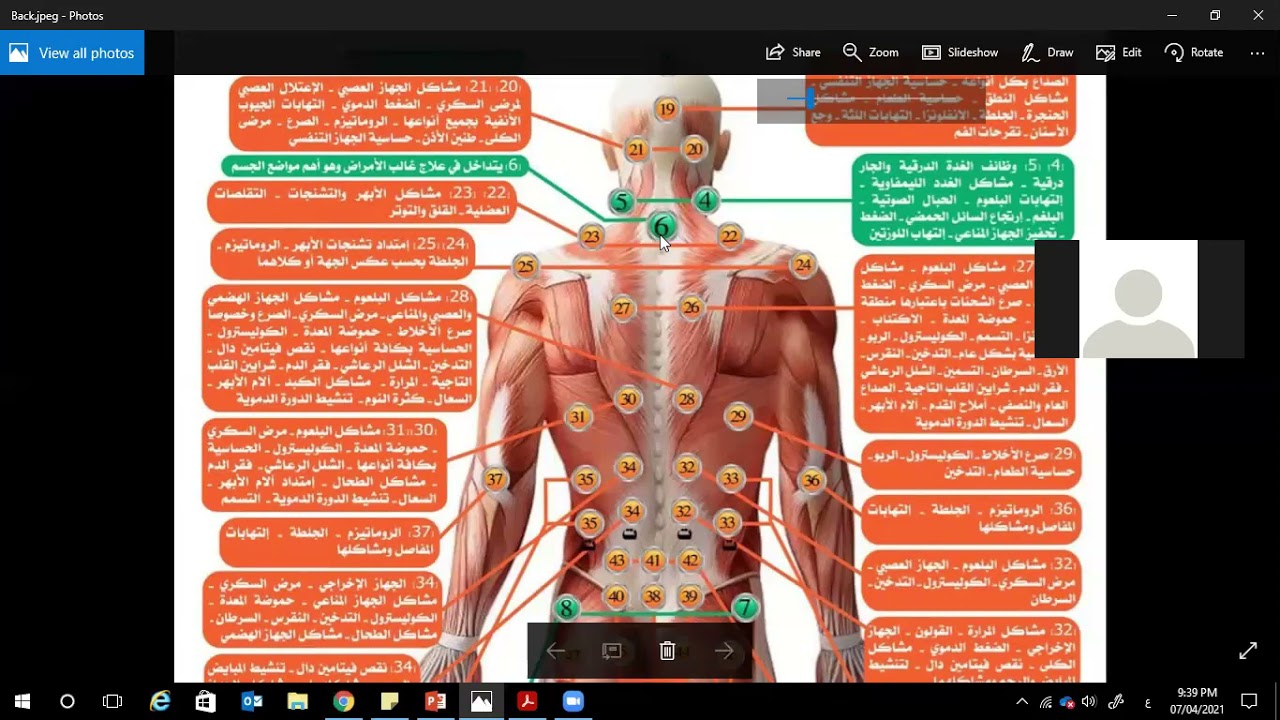 ندوة تعليم الحجامة فى بيتك