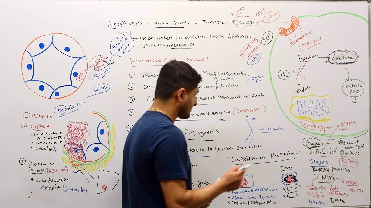 Pathology - Neoplasia | Definitions | Hallmarks of Cancer | Grading | Staging - Subash Acharya