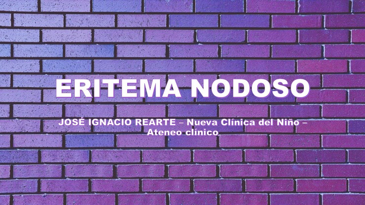 Eritema Nodoso. Prac. Juan Ignacio Rearte