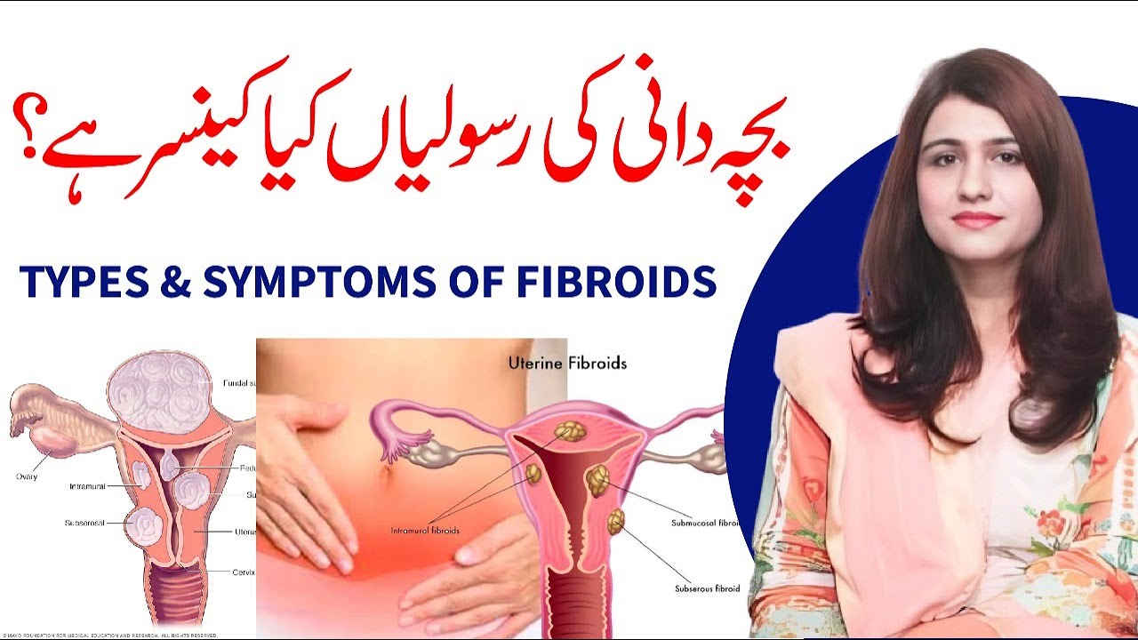 What is Fibroids in Uterus ? Symptoms and Types of Fibroids - Dr Maryam Raana Gynaecologist