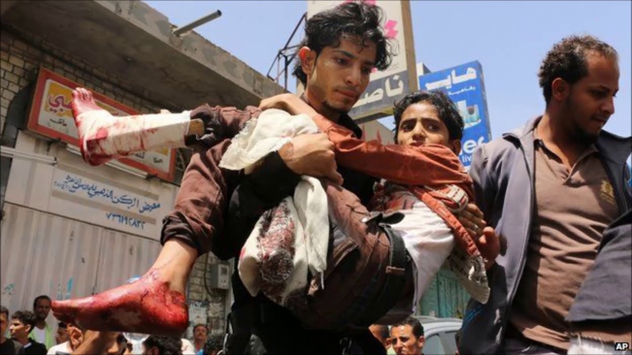 Yemen Civil War Dynamics | Latest Geopolitical analysis