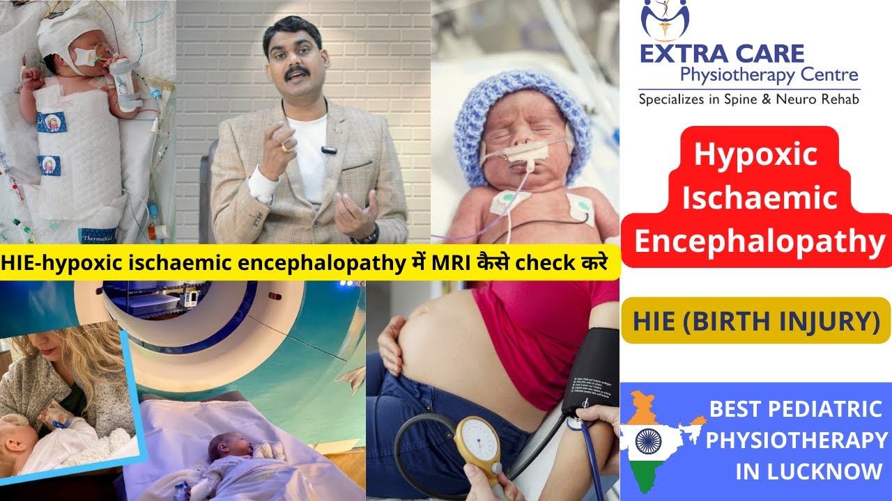 Hypoxic Ischaemic Encephalopathy | HIE in Babies| Birth Injury | Pediatric Physiotherapy in Lucknow
