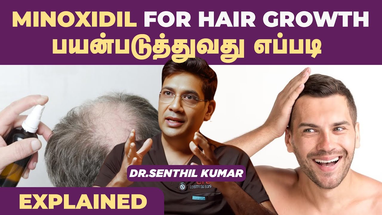 Minoxidil with Doctor Advice | Side effects | Awareness | Creas Cosmetic Clinic | Coimbatore